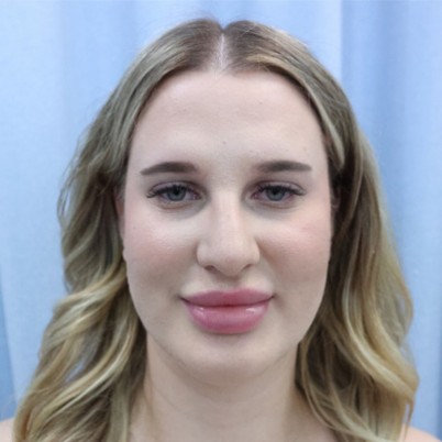 Bea
